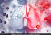 Chinese White Lung Virus Spreads Panicking World White Lung Virus